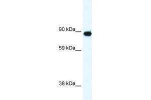 WB Suggested Anti-GRM6 Antibody Titration:  0. (Metabotropic Glutamate Receptor 6 抗体  (C-Term))