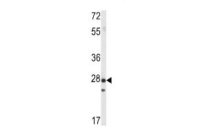 Western blot analysis of PRL1 (ABIN392856 and ABIN2842274) in mouse spleen tissue lysates (35 μg/lane). (PTP4A1 抗体)