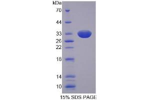 SDS-PAGE analysis of Human SLC22A11 Protein. (SLC22A11 蛋白)