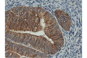 Image no. 5 for anti-Farnesyl-Diphosphate Farnesyltransferase 1 (FDFT1) antibody (ABIN1498243)