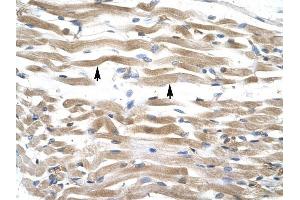 KIFC2 antibody was used for immunohistochemistry at a concentration of 4-8 ug/ml to stain Skeletal muscle cells (lndicated with Arrows) in Human Muscle. (KIFC2 抗体  (N-Term))