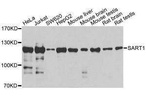 Western blot analysis of extracts of various cell lines, using SART1 antibody (ABIN5996293) at 1/1000 dilution. (SART1 抗体)