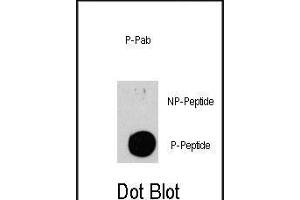Dot blot analysis of anti-TSC2-p Phospho-specific Pab (Cat. (Tuberin 抗体  (pSer939))