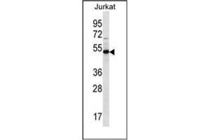 Western blot analysis of FA8A1 Antibody (N-term) in Jurkat cell line lysates (35ug/lane).
