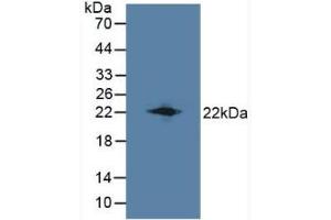 Detection of LCN8 in Mouse Testis Tissue using Polyclonal Antibody to Lipocalin 8 (LCN8) (LCN8 抗体  (AA 27-176))