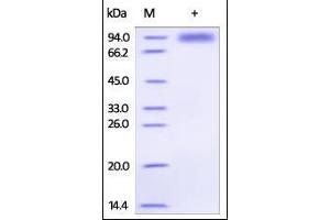SDS-PAGE (SDS) image for Interleukin 1 Receptor-Like 1 (IL1RL1) (AA 19-323) (Active) protein (Fc Tag) (ABIN2181368)