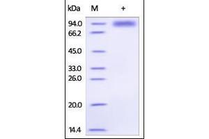 Human IL-1RL1, Fc Tag on SDS-PAGE under reducing (R) condition. (IL1RL1 Protein (AA 19-323) (Fc Tag))