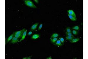 Immunofluorescent analysis of HepG2 cells using ABIN7167597 at dilution of 1:100 and Alexa Fluor 488-congugated AffiniPure Goat Anti-Rabbit IgG(H+L) (RGS19 抗体  (AA 1-87))