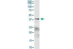 SPDEF polyclonal antibody (A01). (SPDEF/PSE 抗体  (AA 1-335))