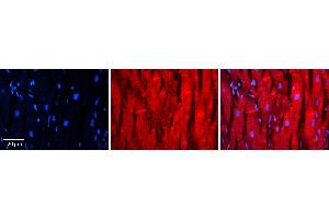 Rabbit Anti-TXN Antibody Catalog Number: ARP72618_P050 Formalin Fixed Paraffin Embedded Tissue: Human heart Tissue Observed Staining: Cytoplasmic near intercalated discs Primary Antibody Concentration: 1:100 Other Working Concentrations: N/A Secondary Antibody: Donkey anti-Rabbit-Cy3 Secondary Antibody Concentration: 1:200 Magnification: 20X Exposure Time: 0. (TXN 抗体  (C-Term))