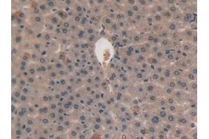 Detection of VEGFC in Mouse Liver Tissue using Polyclonal Antibody to Vascular Endothelial Growth Factor C (VEGFC) (VEGFC 抗体  (AA 108-223))