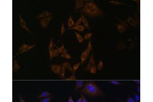 Immunofluorescence analysis of HeLa cells using UBE2L6 Polyclonal Antibody at dilution of 1:100. (UBE2L6 抗体)