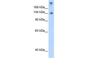 Western Blotting (WB) image for anti-Splicing Factor 3b, Subunit 1, 155kDa (SF3B1) antibody (ABIN2462069) (SF3B1 抗体)