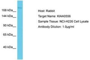 Image no. 1 for anti-KIAA0556 (KIAA0556) (AA 142-191) antibody (ABIN6750570) (KIAA0556 抗体  (AA 142-191))