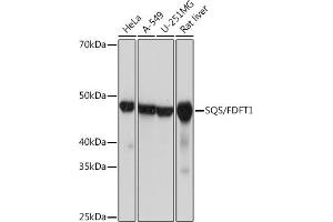 Western blot analysis of extracts of various cell lines, using SQS/FDFT1 Rabbit mAb (ABIN7267130) at 1:1000 dilution. (FDFT1 抗体)