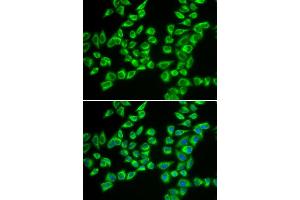 Immunofluorescence (IF) image for anti-Hydroxyacyl-CoA Dehydrogenase/3-Ketoacyl-CoA Thiolase/enoyl-CoA Hydratase (Trifunctional Protein), beta Subunit (HADHB) antibody (ABIN2562992)
