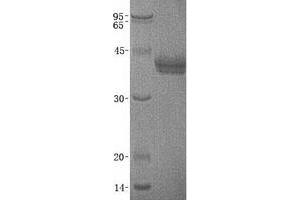 Western Blotting (WB) image for Cell Adhesion Molecule 3 (CADM3) (Transcript Variant 2) protein (His tag) (ABIN2713031)