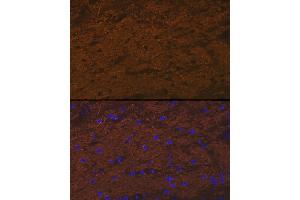 Immunofluorescence analysis of rat brain cells using TMOD2 Rabbit mAb (ABIN7271011) at dilution of 1:100 (40x lens). (TMOD2 抗体)