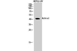Western Blotting (WB) image for anti-Actin, alpha 1, Skeletal Muscle (ACTA1) (N-Term) antibody (ABIN3183158) (Actin 抗体  (N-Term))