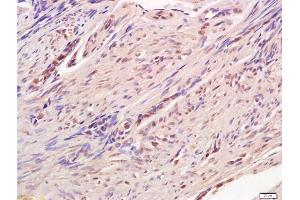 Formalin-fixed and paraffin embedded human endometrium labeled with Anti-CREB-1 Polyclonal Antibody, Unconjugated (ABIN723950) at 1:200 followed by conjugation to the secondary antibody and DAB staining (CREB1 抗体  (AA 101-150))