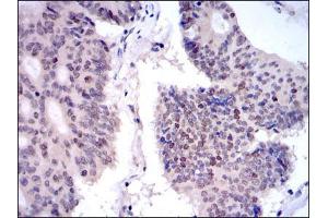Immunohistochemistry (IHC) image for anti-Kinesin Family Member 22 (KIF22) antibody (ABIN969236)