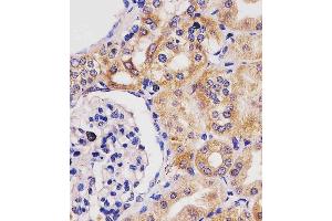 (ABIN6243842 and ABIN6577230) staining GLS2 in human kidney tissue sections by Immunohistochemistry (IHC-P - paraformaldehyde-fixed, paraffin-embedded sections). (GLS2 抗体)