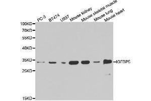 Western blot analysis of extracts of various cell lines, using IGFBP5 antibody. (IGFBP5 抗体  (AA 21-272))