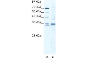 Human Jurkat; WB Suggested Anti-SOX12 Antibody. (SOX12 抗体  (C-Term))