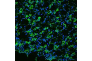 Immunohistochemistry analysis using Rabbit Anti-Aquaporin 1 Polyclonal Antibody . (Aquaporin 1 抗体  (N-Term) (Biotin))