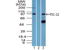 Image no. 1 for anti-TSC22 Domain Family, Member 1 (TSC22D1) (AA 100-150) antibody (ABIN960389) (TSC22D1 抗体  (AA 100-150))