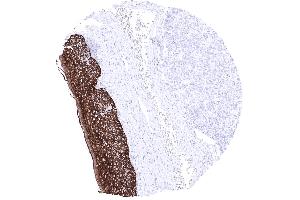 Tonsil surface Epithelium A strong KRT15 immunostaining is found in all cell layers of all non keratinizing and keratinizing squamous epithelium except keratin layer (KRT15 抗体)