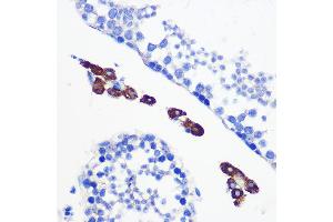 Immunohistochemistry of paraffin-embedded mouse testis using [KO Validated] Bax Rabbit mAb (ABIN7265855) at dilution of 1:100 (40x lens). (BAX 抗体)
