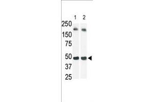 The anti-SphK1 Pab (ABIN391345 and ABIN2841366) is used in Western blot (Lane 2) to detect c-myc-tagged SphK1 in transfected 293 cell lysate (a c-myc antibody is used as control in Lane 1). (SPHK1 抗体  (N-Term))