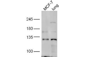 line1, MCF-7 lysate; line2,mouse lung lysate probed with Rabbit Anti-HNRPUL1 Polyclonal Antibody, Unconjugated  at 1:5000 for 90min at 37˚C. (HNRNPUL1 抗体  (AA 701-800))