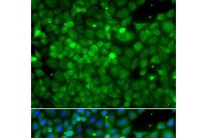 Immunofluorescence analysis of A549 cells using POC1A Polyclonal Antibody (POC1A 抗体)
