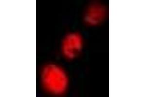 Immunofluorescent analysis of Cofilin 2 staining in A549 cells. (Cofilin 2 抗体)