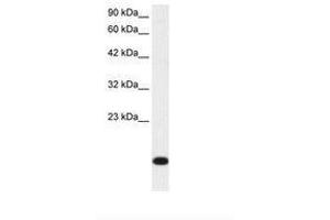 Image no. 1 for anti-Ribosomal Protein S16 (RPS16) (N-Term) antibody (ABIN202031) (RPS16 抗体  (N-Term))