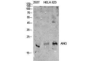 Western Blotting (WB) image for anti-Angiotensinogen (serpin Peptidase Inhibitor, Clade A, Member 8) (AGT) (Internal Region) antibody (ABIN6287562)
