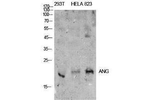 Western Blotting (WB) image for anti-Angiotensinogen (serpin Peptidase Inhibitor, Clade A, Member 8) (AGT) (Internal Region) antibody (ABIN3181398)