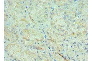 Immunohistochemistry of paraffin-embedded human kidney tissue using ABIN7145826 at dilution of 1:100 (BOC 抗体  (AA 1-125))