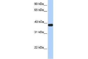 WB Suggested Anti-ASB5 Antibody Titration:  0. (ASB5 抗体  (C-Term))