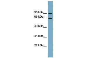 SLC12A8 antibody used at 1 ug/ml to detect target protein. (SLC12A8 抗体)