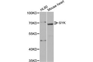 Western blot analysis of extracts of various cell lines, using SYK antibody (ABIN5971150) at 1/500 dilution. (SYK 抗体)
