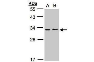 WB Image Sample (30μg whole cell lysate) A:MOLT4 , B:Raji , 12% SDS PAGE antibody diluted at 1:500 (XRCC2 抗体)