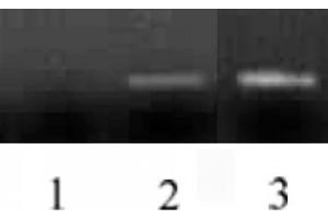 Histone H3 antibody (mAb) tested by ChIP. (Histone 3 抗体  (N-Term))