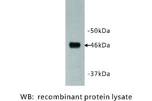 Image no. 1 for anti-Dachsous 1 (DCHS1) antibody (ABIN1112924) (DCHS1 抗体)