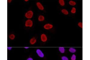 Confocal immunofluorescence analysis of U2OS cells using KU70 Polyclonal Antibody at dilution of 1:100. (XRCC6 抗体)