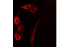 ABIN6277853 staining HeLa cells by IF/ICC. (CASP5 抗体)
