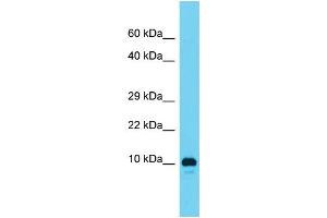Host: Rabbit  Target Name: RGD1561459  Sample Tissue: Rat Testis lysates  Antibody Dilution: 1. (AAMDC 抗体  (N-Term))