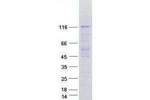 Western Blotting (WB) image for Ubiquitin Specific Peptidase 1 (USP1) (Transcript Variant 3) protein (Myc-DYKDDDDK Tag) (ABIN2735085)